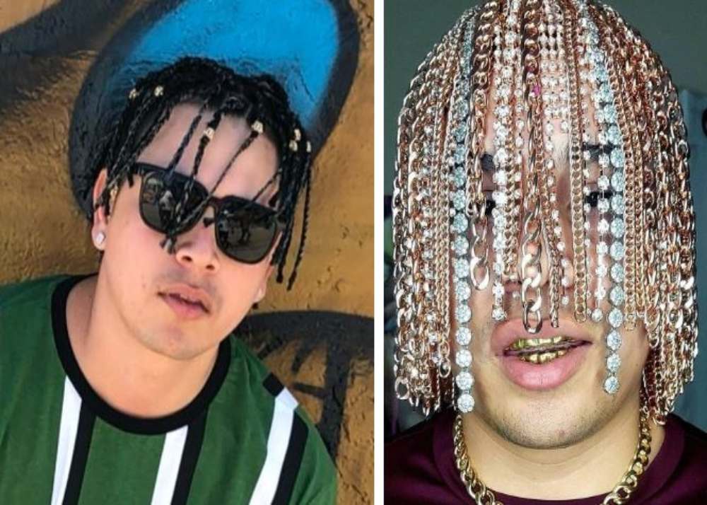 Mexican rapper gets gold chains implanted into scalp  The Tribune India